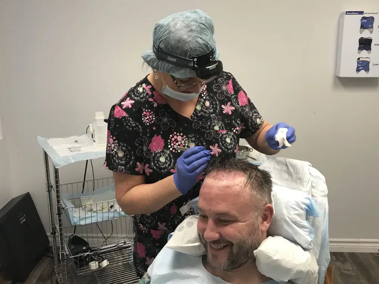 Hair transplant surgery at Hair Loss Experts